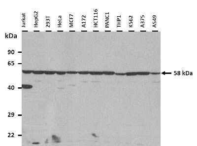 Western Blot: TCP1-delta Antibody [NBP3-10317]